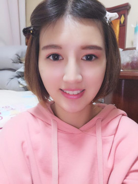 注射瘦臉去抬頭紋，找回屬于我的年齡，感謝金頌良醫(yī)生！