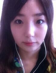 深圳希思崔院長隆鼻整形 擺脫了豬妹妹的稱號