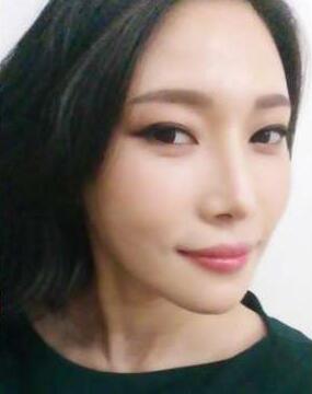 柳大烈給我做的改臉型手術(shù) 求圍觀！