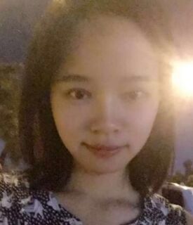 全切雙眼皮+去脂肪，終于擺脫小眼睛了