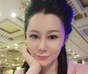 隆鼻失敗修復(fù)后再次獲得完精致的美鼻