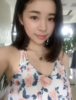 合肥楊鵬隆鼻整形真實案例分享