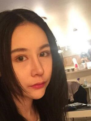 成都天使之翼做隆鼻整形改變了我的塌鼻子 果真的很不錯(cuò)