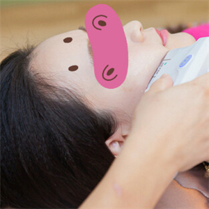 黃慶武醫(yī)生做的音波拉皮除皺手術分享，有很多前后對比果圖片哦~~~