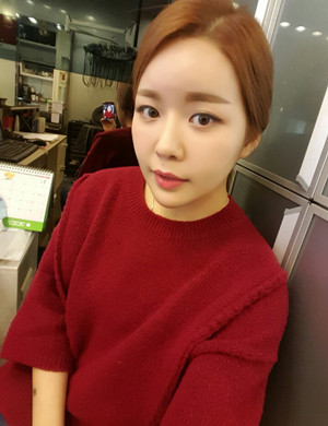 v－line手術(shù)后變小臉美眉 伊美爾孫麗君做的