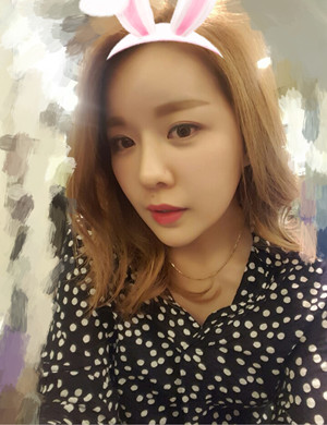 v－line手術(shù)后變小臉美眉 伊美爾孫麗君做的