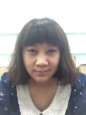 秦宏偉給我做了埋埋蛋白線.提升 變年輕了