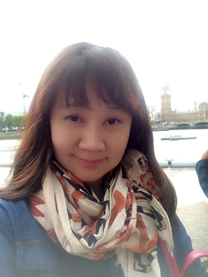 秦宏偉給我做了埋埋蛋白線.提升 變年輕了