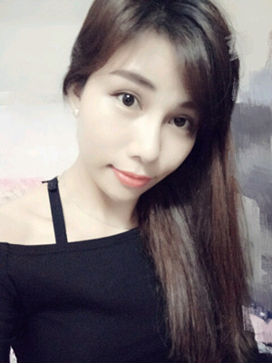 美萊鄧正輝做的切開(kāi)雙眼皮 終于變美了