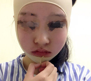 磨骨瘦臉后，終于擺脫大餅?zāi)樍耍? /> </a>
										<a href=