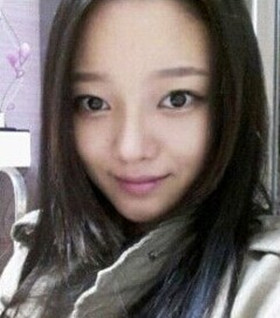 假體隆鼻手術(shù)過程前后對比圖片