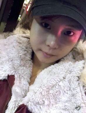 柳大烈給我做的磨下頜角 看看我的果如何~