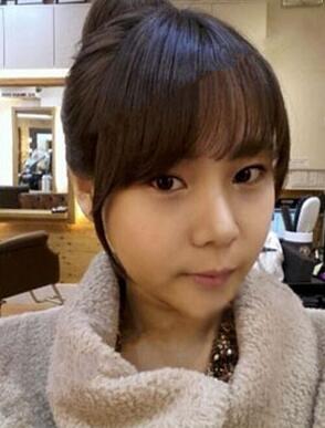 柳大烈給我做的磨下頜角 看看我的果如何~