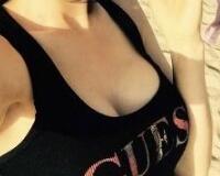 假體隆胸價(jià)格和恢復(fù)過(guò)程前后對(duì)比圖