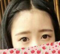 一次性做了全切雙眼皮和開(kāi)內(nèi)眼角兩項(xiàng)整形，佩服自己的勇氣