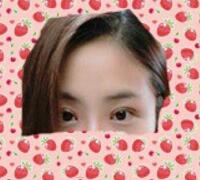 割雙眼皮開眼角術(shù)后恢復(fù)圖