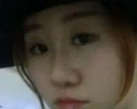 同學(xué)做了隆鼻，我也去做了個假體隆鼻，臉型真心立體了好多