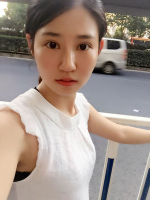 看了顏玲做的雙眼皮多項整形 你們心動了沒