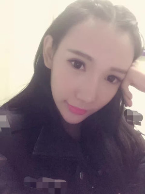 隆鼻整形做完之后人也美了 軍美顏玲做的