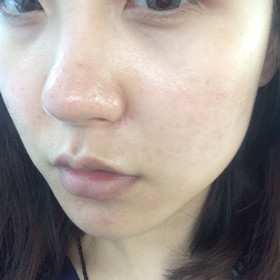 做了黑臉娃娃后，Duang的一下就變成“白雪公主”啦