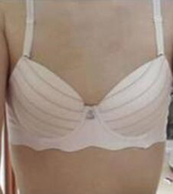 北京常好麗格三點定位雙眼皮恢復一個月經歷