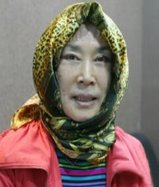 拉皮除皺手術(shù)讓我年輕20歲