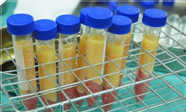 自體脂肪豐胸讓我的小平胸變成大豪乳