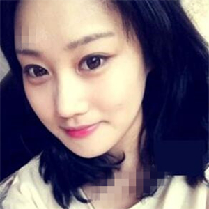 看看我磨下頜角整形手術恢復前后的對比圖片，同學都說我像張馨予~~