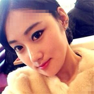 看看我磨下頜角整形手術恢復前后的對比圖片，同學都說我像張馨予~~