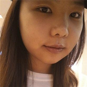 磨下頜角磨骨手術(shù)一個月了，分享一下恢復(fù)前后的果照片哇~