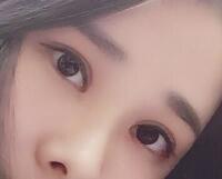 切開雙眼皮價格2680元，費用不貴果卻很好