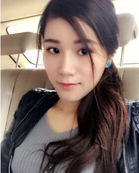 鼻頭巨大做了鼻翼縮小術(shù)后秀氣了不少