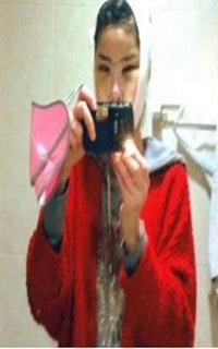 做了磨顴骨手術(shù)的我從小鴨子變成白天鵝 謝謝柳大烈教授