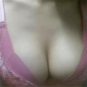 分享娜高假體豐胸手術(shù)恢復(fù)過程，還有前后對比果圖片哦~~