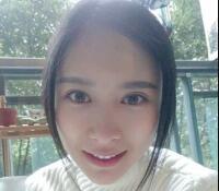 大腿吸脂做自體脂肪面部填充三個(gè)月了，分享給大家