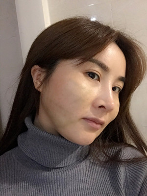 埋埋蛋白線.提升后心態(tài)也年輕了 維多利亞劉中策做的