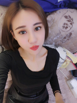 劉中策做的開內(nèi)眼角 眼睛好漂亮