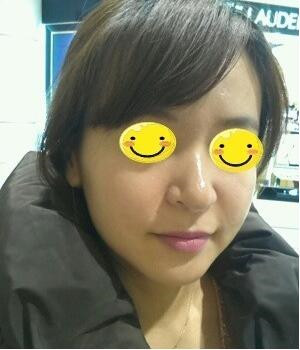 光子嫩膚后，整個人漂亮多了