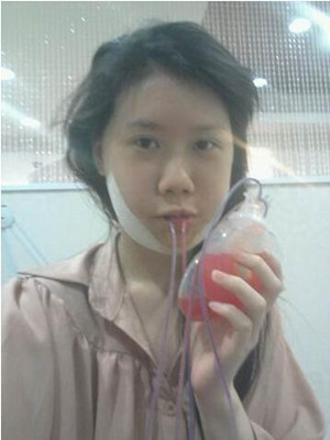 磨了下頜角和顴骨的我 變成小仙女了