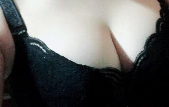 自體脂肪隆胸術(shù)后20天恢復(fù)圖