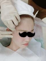 剛做埋埋蛋白線.提升沒多久，大家來看看果如何