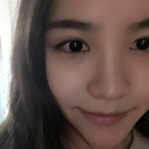 埋埋蛋白線.提升后臉上變得緊致許多，輪廓變得更好看