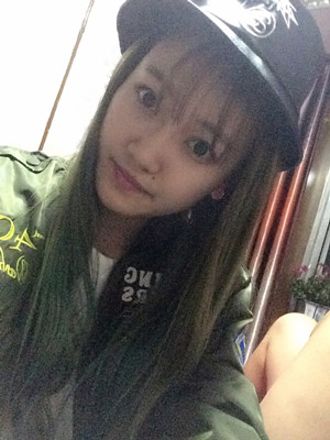 東方麗人陸忠凱做的注射瘦臉 臉變小了