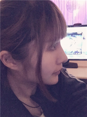 玻尿酸隆鼻后意想不到的果 陸忠凱做的