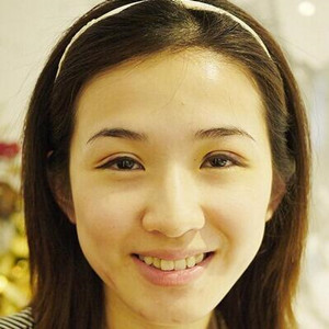 雙眼皮手術(shù)前后過程以及真實(shí)案例分享
