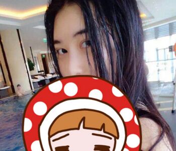 雙眼皮開眼角修復(fù)眼睛終于變得正常好看了