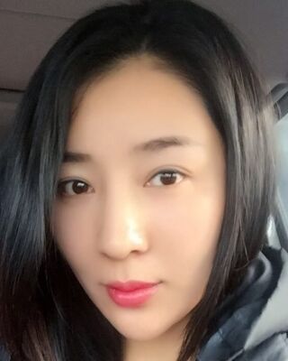 埋埋蛋白線.提升整個(gè)面部年輕很多，小V臉也出來(lái)了