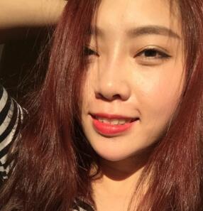 自體脂肪隆鼻、墊下巴、豐蘋果肌前后對比圖和恢復(fù)過程分享