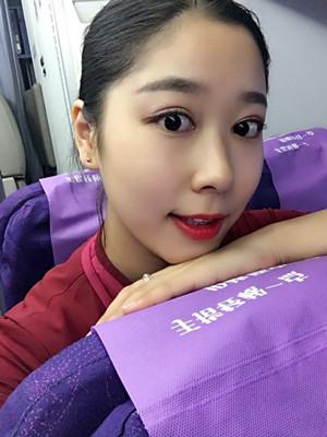 你們來看看翟爽做的切開雙眼皮怎么樣