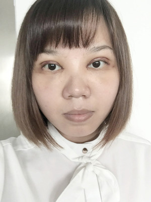 做了雙眼皮多項(xiàng)整形手術(shù)，大家來看看果如何